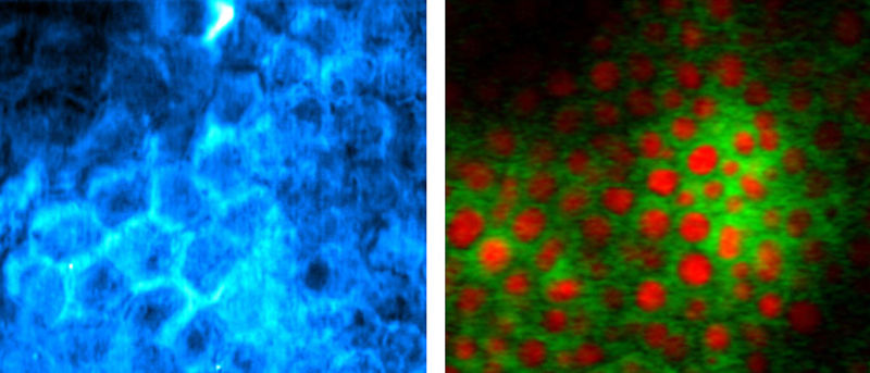 Colored images of cells and their DNA.