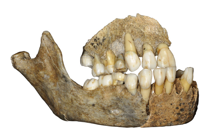 The upper and lower jawbones of a juvenile Neanderthal girl who lived in Belgium around 127,000 years ago.