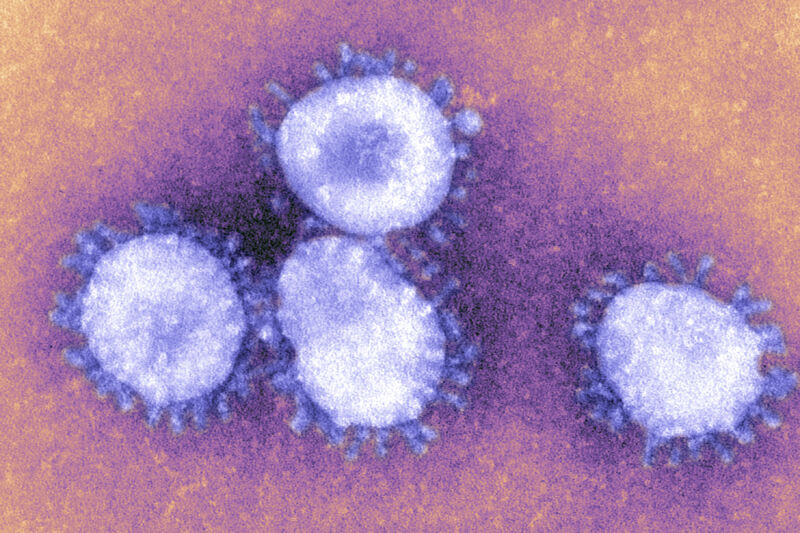 Coronaviruses 