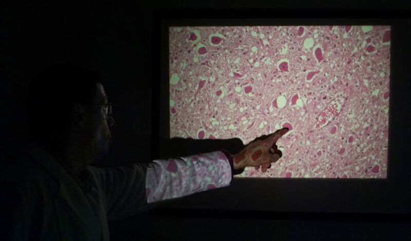 An arm points at a video projection of gross pink goo.