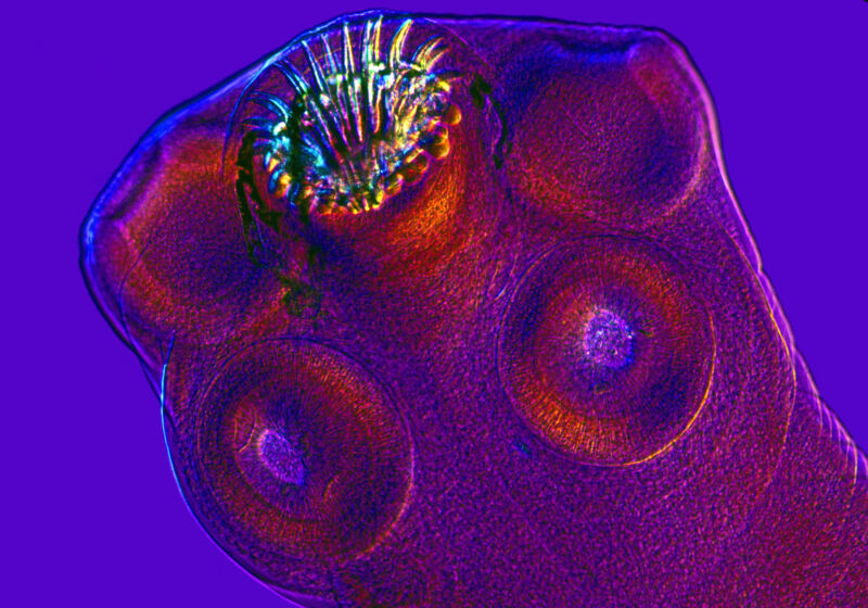 Psychedelic image of microscopic parasite.