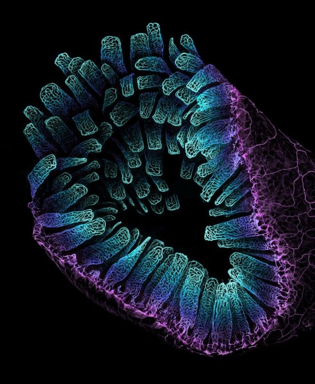 Satu Paavonsalo and Sinem Karaman, University of Helsinki, Finland: "Blood vessel networks in the intestine of an adult mouse."