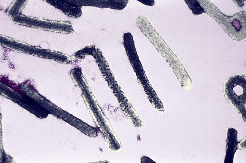 An electron micrograph of a number of Marburg virions responsible for causing Marburg virus disease.