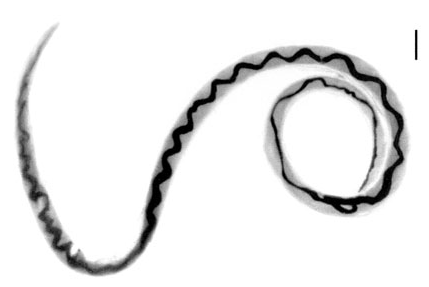 Adult female worm of <em>Angiostrongylus cantonensis</em> recovered from rat lungs with characteristic barber-pole appearance (anterior end of worm is to the top). Scale bar = 1 mm.”><figcaption class=