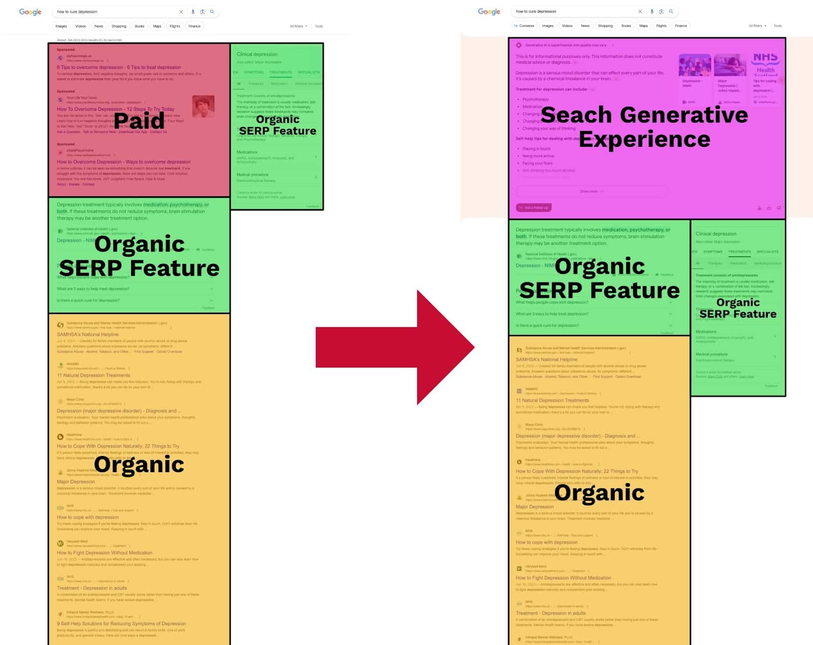 A screenshot with the comparison of two SERPs. Both show the query "how to cure depression". There are coloured boxes that show the different SERP features. On the left side SERP (the traditional, current Google search) there is a big block with paid ads above the regular results and a knowledge panel next to it on the right. Below the paid ads there is a block of organic Google SERP features and below that the regular organic results start. The SERP on the right is build differently. The paid ads are switched for the SGE AI overview. The organic SERP features are below that. The regular organic results start below the organic SERP features once again.