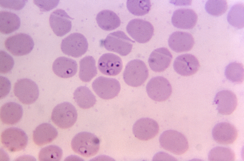 Under a magnification of 1,125x, this photomicrograph of a blood specimen revealed the presence of intraerythrocytic <em>Plasmodium falciparum</em> ring-form trophozoites. Note the erythrocyte in the center contained four ring-staged trophozoites and that all rings exhibited a single chromatin dot.”><figcaption class=