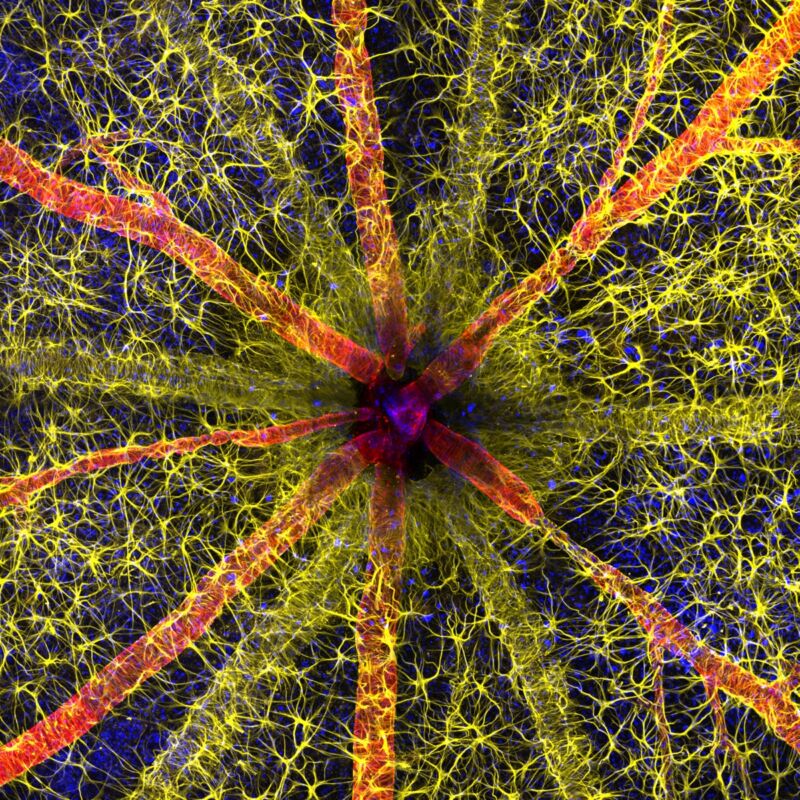 a rodent optic nerve head with astrocytes (yellow), contractile proteins (red), and retinal vasculature (green).