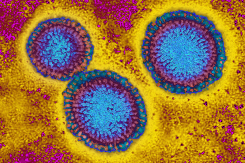 The influenza virus from an image produced from an image taken with transmission electron microscopy. Viral diameter ranges from around 80 to 120 nm.