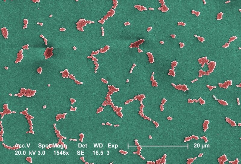 This Scanning Electron Microscope image depicts several clusters of aerobic Gram-negative, non-motile <i>Acinetobacter baumannii</i> bacteria under a magnification of 24,730x. Members of the genus <i>Acinetobacter</i> are nonmotile rods, 1-1.5µm in diameter, and 1.5-2.5µm in length, becoming spherical in shape while in their stationary phase of growth. This bacteria is oxidase-negative and therefore does not utilize oxygen for energy production. They also occur in pairs under magnification. <i>Acinetobacter spp.</i> are widely distributed in nature, and are normal flora on the skin. Some members of the genus are important because they are an emerging cause of hospital acquired pulmonary, i.e., pneumoniae, hemopathic, and wound infections. Because the organism has developed substantial antimicrobial resistance, treatment of infections attributed to A. baumannii has become increasingly difficult. The only drug that works on multi-resistant strains of A.baumannii is colistin which is a very toxic drug.”><figcaption class=