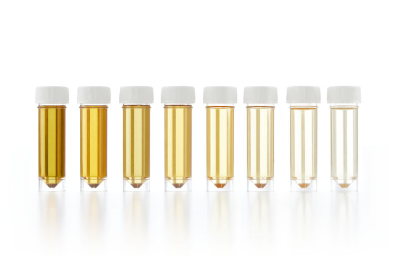 Image of a series of scientific sample tubes filled with yellow liquids.