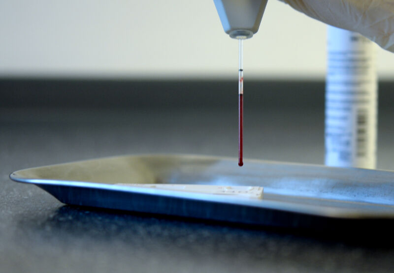 Drops of the blood going onto an HIV quick test.